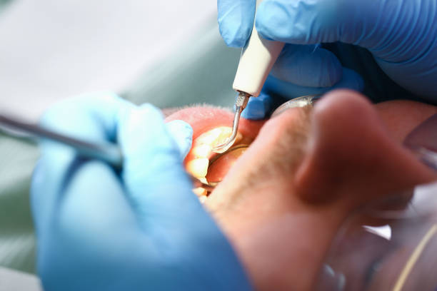 Best Urgent Care for Lost Fillings or Crowns in West Rancho Dominguez, CA