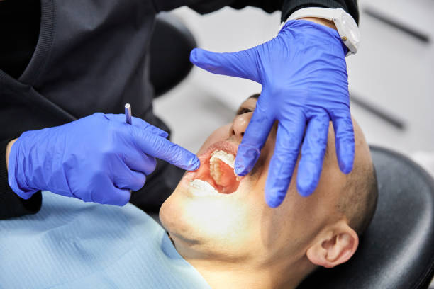 Best Emergency Treatment for Dental Infections or Abscesses in West Rancho Dominguez, CA